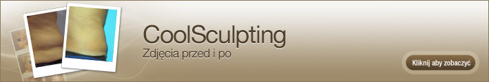 coolsculpting-before-and-after-pictures-pl